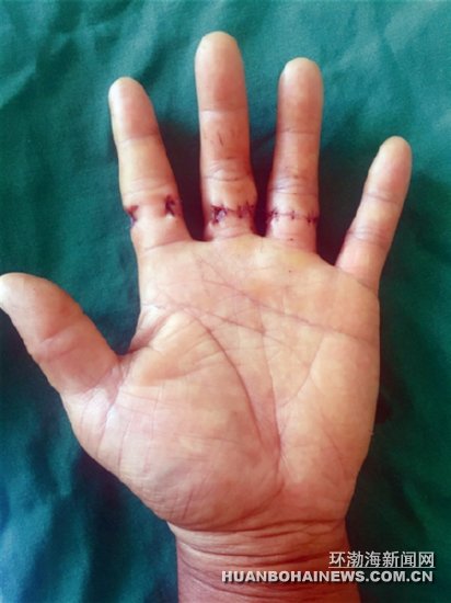 һ����3����ָ��ľ�����ɡ��Ǻ�«��